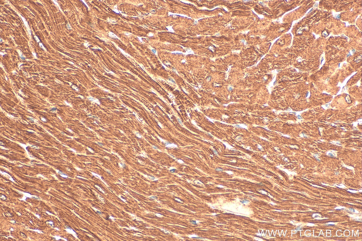 Immunohistochemical analysis of paraffin-embedded mouse heart tissue slide using 55108-1-AP (ATP13A3 antibody) at dilution of 1:200 (under 40x lens). Heat mediated antigen retrieval with Tris-EDTA buffer (pH 9.0). Immunohistochemistry (IHC) staining of mouse heart tissue using ATP13A3 Polyclonal antibody (55108-1-AP)