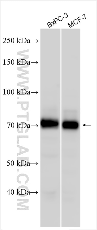 Western Blot (WB) analysis of various lysates using ATP13A3 Polyclonal antibody (55108-1-AP)