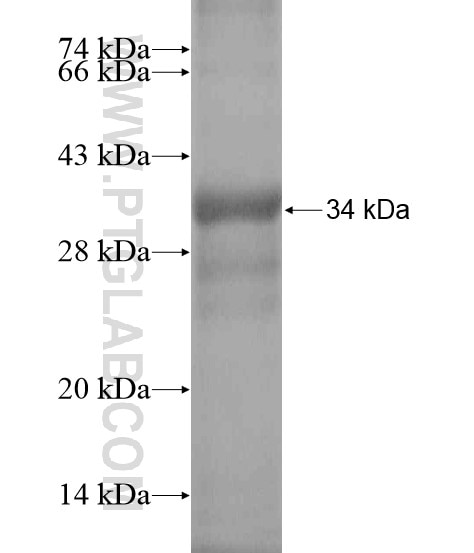 ATP13A4 fusion protein Ag20100 SDS-PAGE