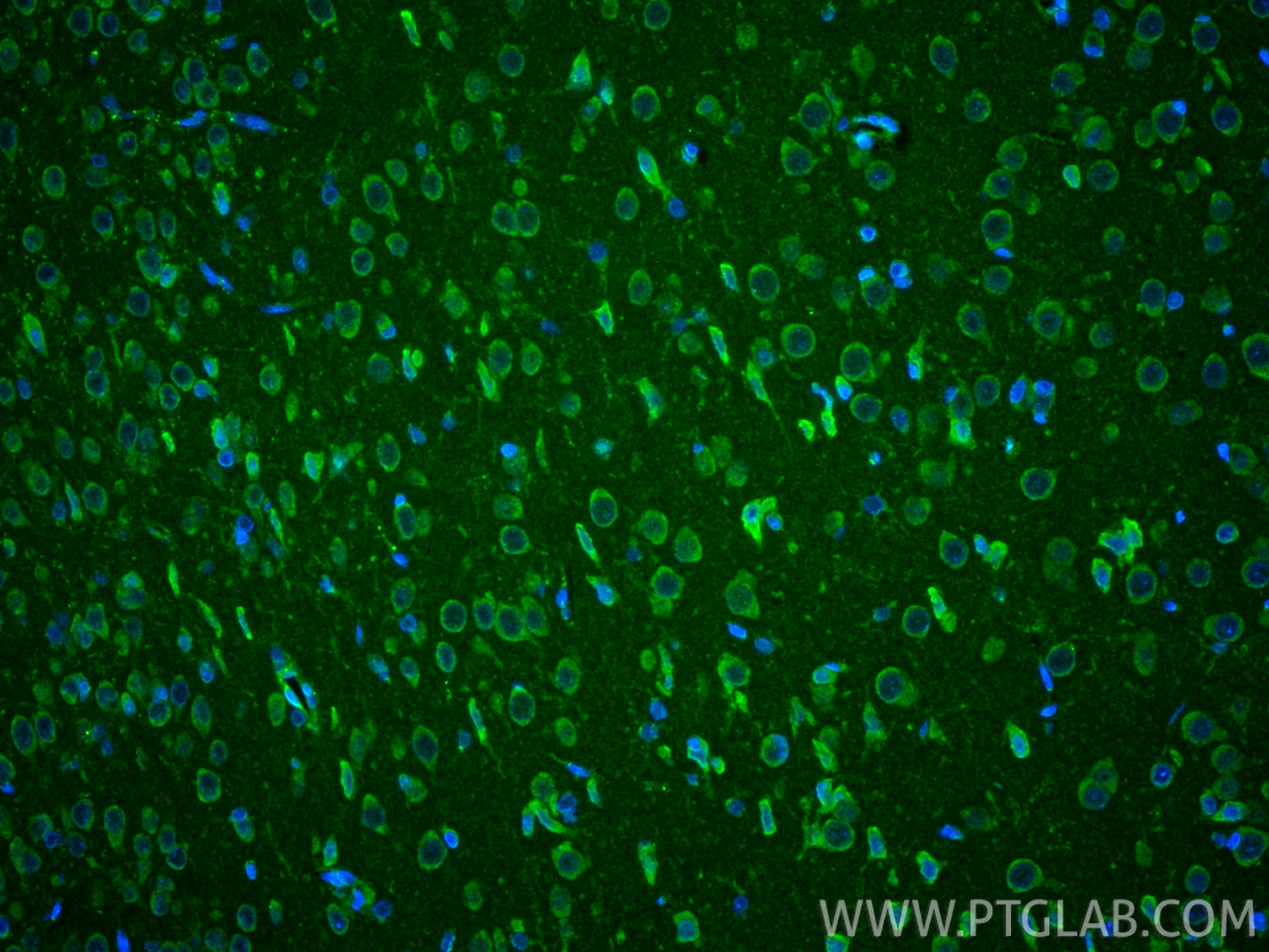 Immunofluorescence (IF) / fluorescent staining of rat brain tissue using ATP13A5 Polyclonal antibody (24676-1-AP)