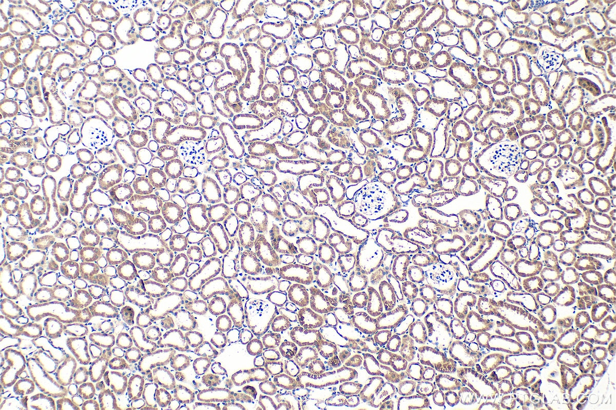Immunohistochemistry (IHC) staining of mouse kidney tissue using ATP13A5 Polyclonal antibody (24676-1-AP)