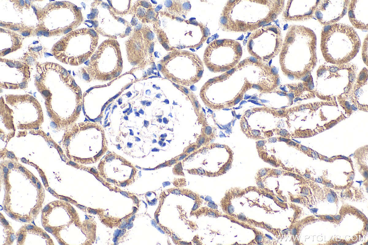 Immunohistochemistry (IHC) staining of mouse kidney tissue using ATP13A5 Polyclonal antibody (24676-1-AP)