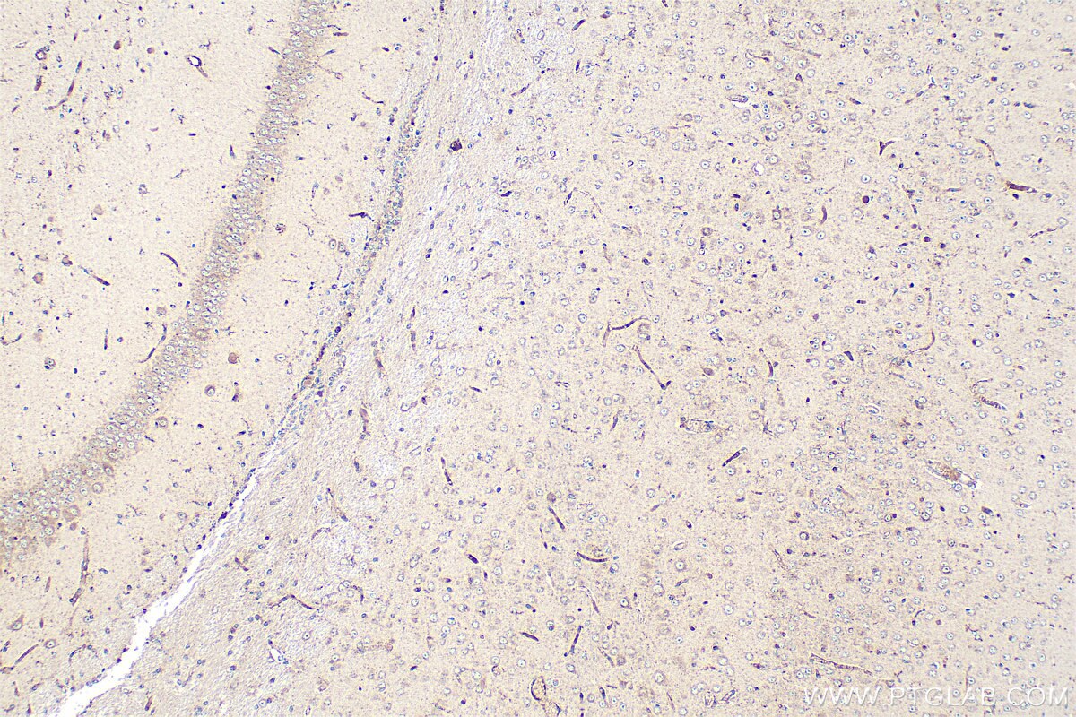 Immunohistochemistry (IHC) staining of mouse brain tissue using ATP13A5 Polyclonal antibody (24676-1-AP)