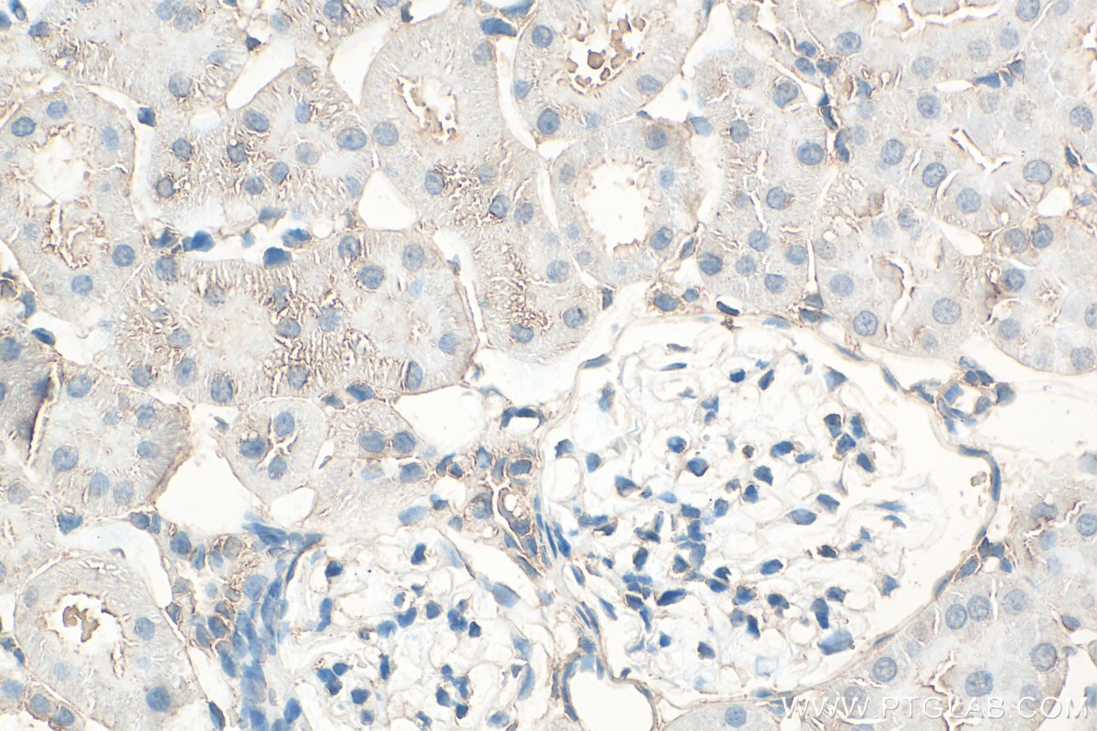 Immunohistochemical analysis of paraffin-embedded rat kidney tissue slide using Biotin-24676 (ATP13A5 antibody) at dilution of 1:200 (under 40x lens). Heat mediated antigen retrieval with Tris-EDTA buffer (pH 9.0). Immunohistochemistry (IHC) staining of rat kidney tissue using Biotin-conjugated ATP13A5 Polyclonal antibody (Biotin-24676)