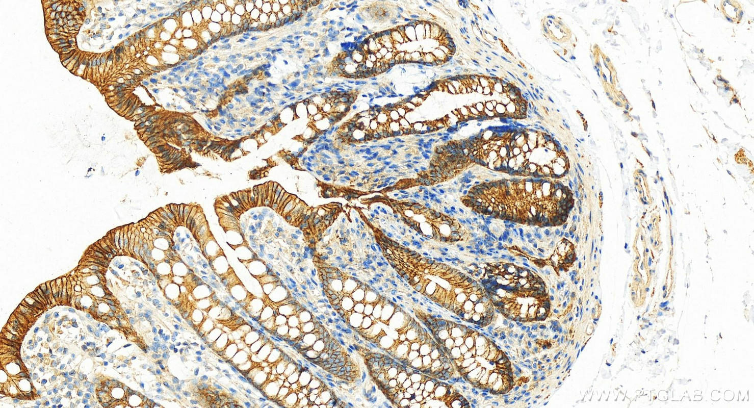 Immunohistochemistry (IHC) staining of human colon tissue using ATP1A1 Polyclonal antibody (14418-1-AP)