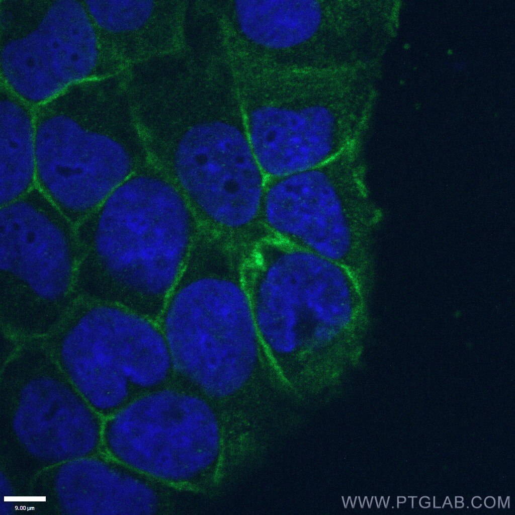 ATP1A1