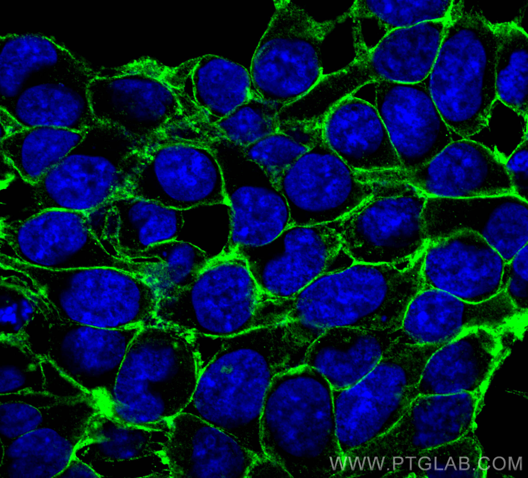 Immunofluorescence (IF) / fluorescent staining of HEK-293 cells using ATP1A1 Polyclonal antibody (14418-1-AP)