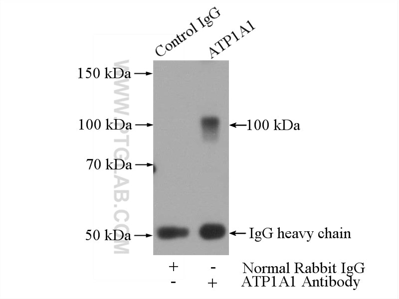 Immunoprecipitation (IP) experiment of HEK-293 cells using ATP1A1 Polyclonal antibody (14418-1-AP)