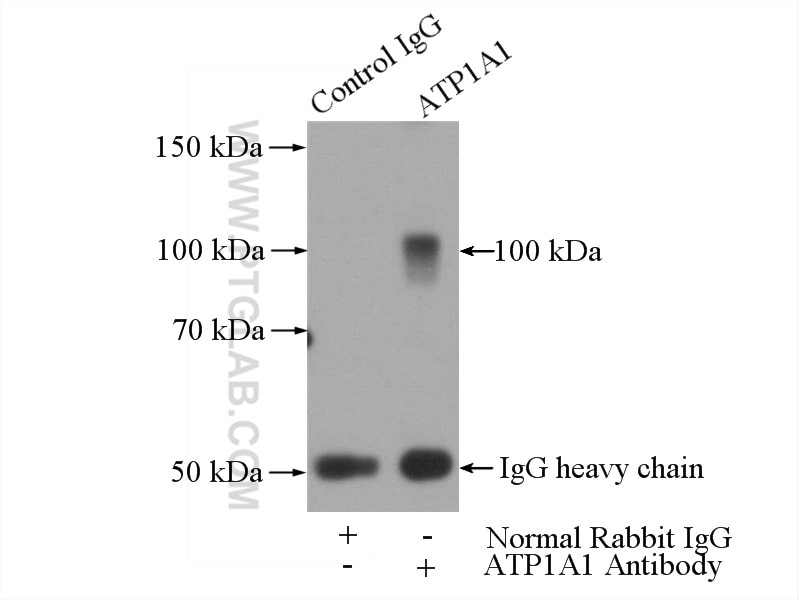 IP experiment of HEK-293 using 14418-1-AP