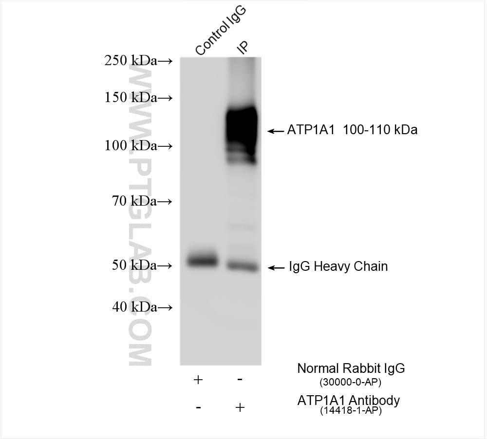 Immunoprecipitation (IP) experiment of HEK-293 cells using ATP1A1 Polyclonal antibody (14418-1-AP)
