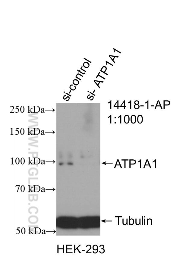 Western Blot (WB) analysis of HEK-293 cells using ATP1A1 Polyclonal antibody (14418-1-AP)