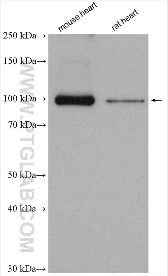 Western Blot (WB) analysis of various lysates using ATP1A1 Polyclonal antibody (14418-1-AP)