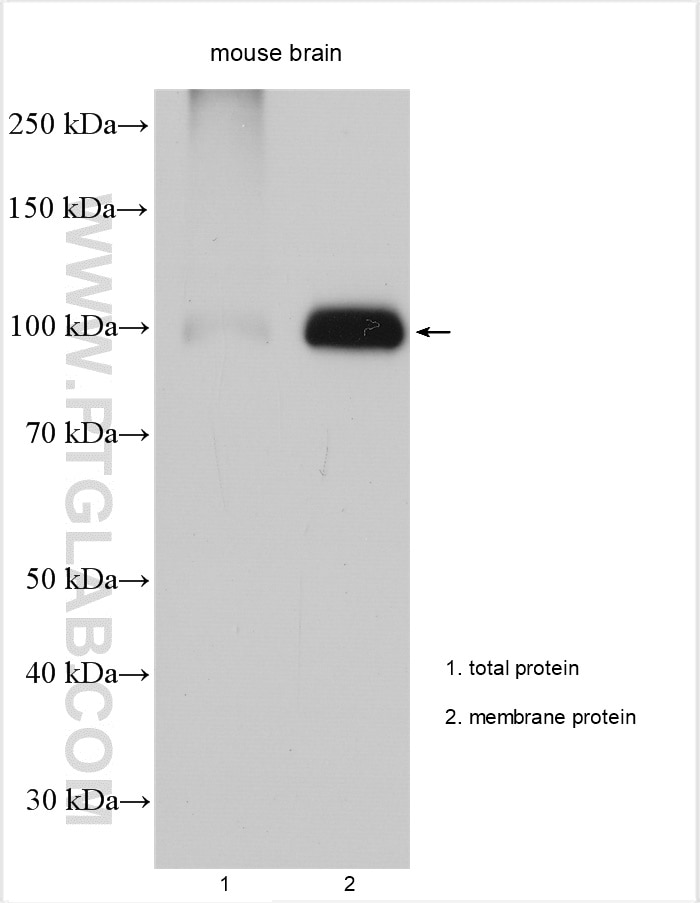 Western Blot (WB) analysis of various lysates using ATP1A1 Polyclonal antibody (14418-1-AP)
