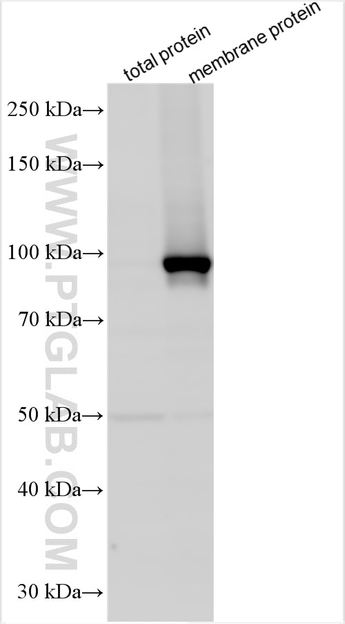 Western Blot (WB) analysis of various lysates using ATP1A1 Polyclonal antibody (14418-1-AP)