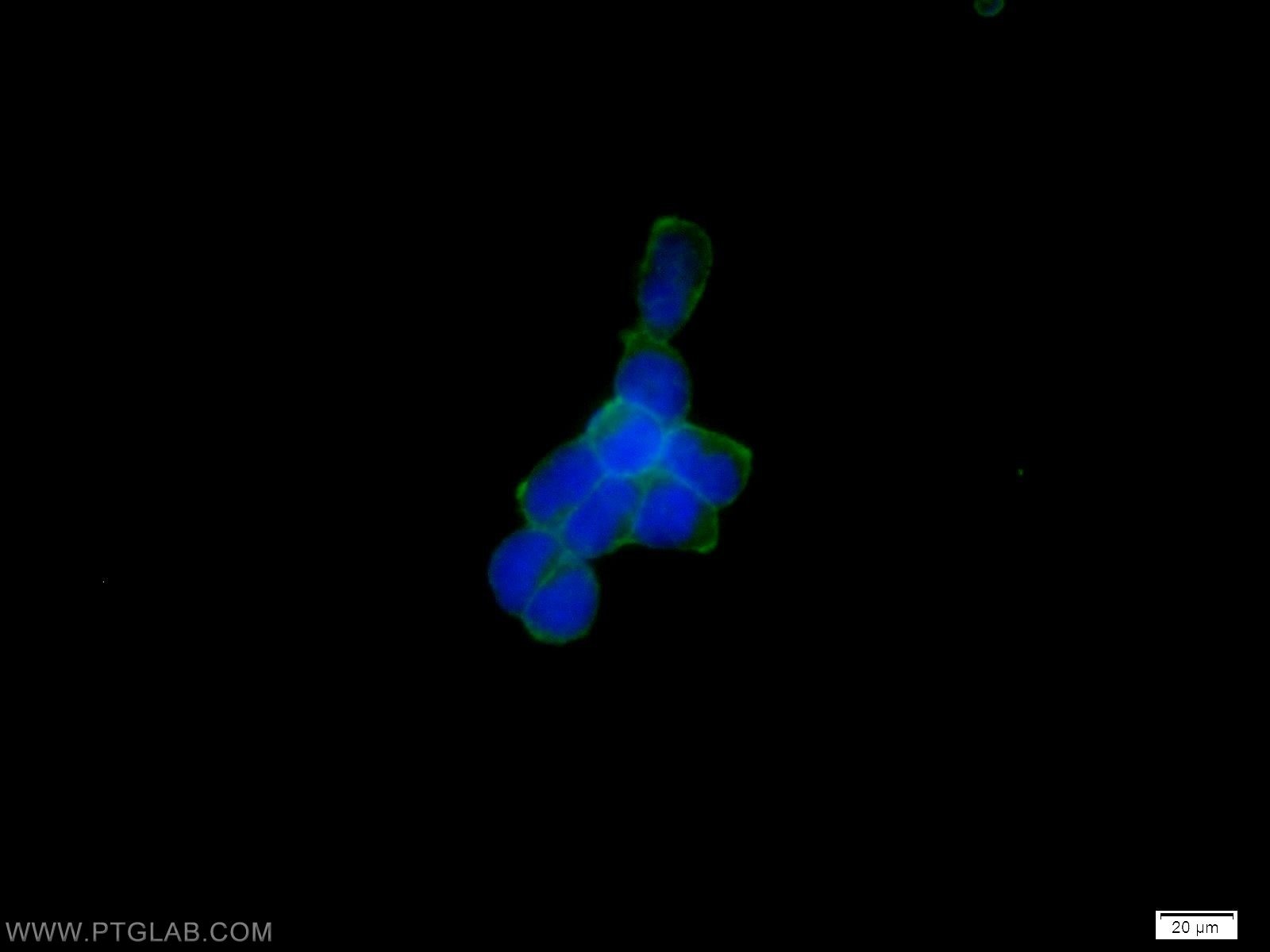 ATP1A1-Specific