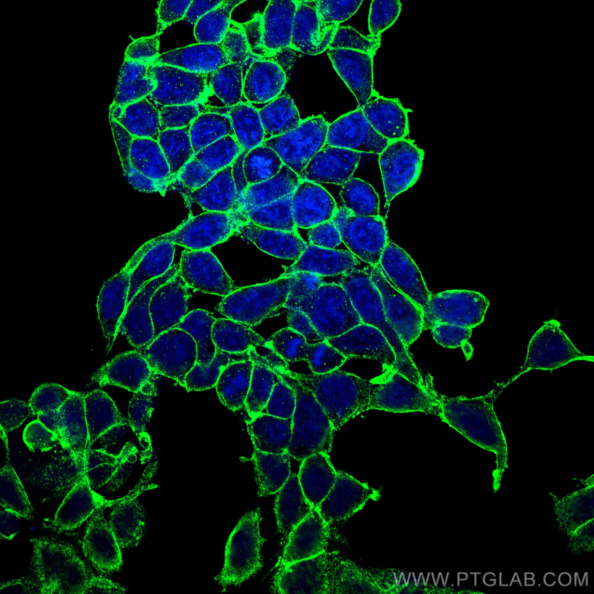 Immunofluorescence (IF) / fluorescent staining of HEK-293 cells using ATP1A1-Specific Polyclonal antibody (55187-1-AP)