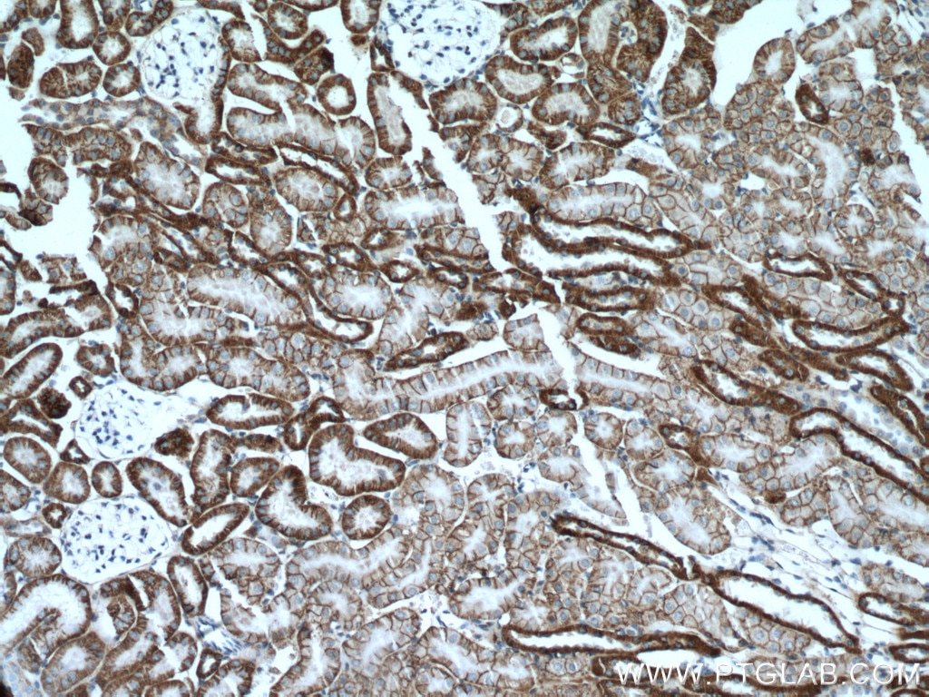 Immunohistochemistry (IHC) staining of mouse kidney tissue using ATP1A1-Specific Polyclonal antibody (55187-1-AP)