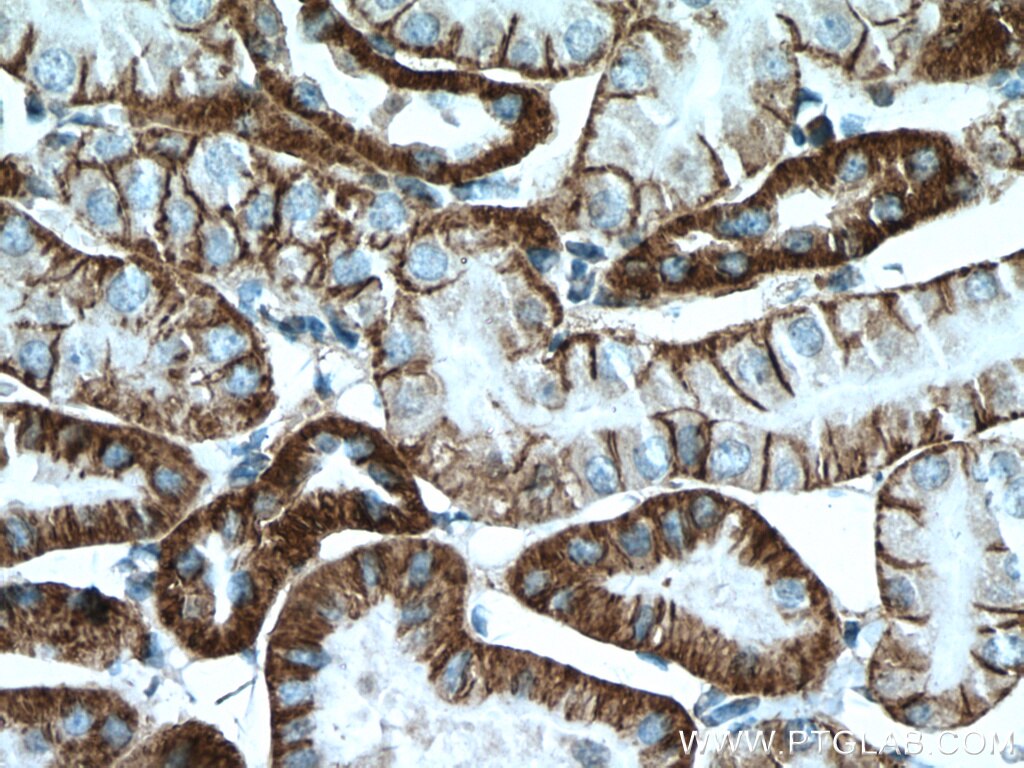 Immunohistochemistry (IHC) staining of mouse kidney tissue using ATP1A1-Specific Polyclonal antibody (55187-1-AP)