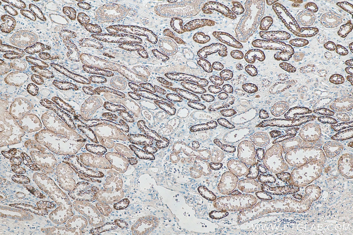 Immunohistochemistry (IHC) staining of human kidney tissue using ATP1A1-Specific Polyclonal antibody (55187-1-AP)