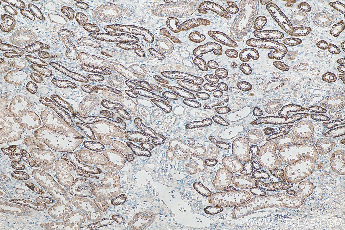 IHC staining of human kidney using 55187-1-AP