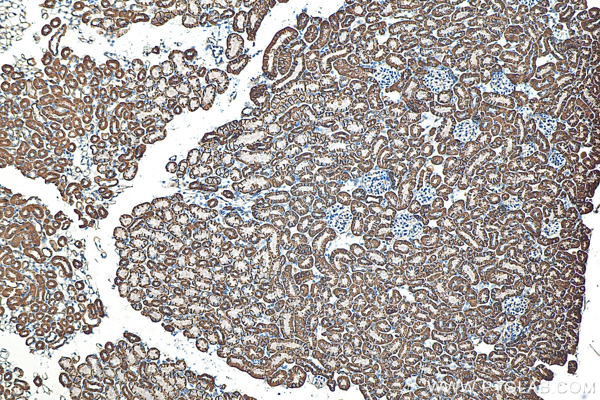 Immunohistochemistry (IHC) staining of mouse kidney tissue using ATP1A1-Specific Polyclonal antibody (55187-1-AP)