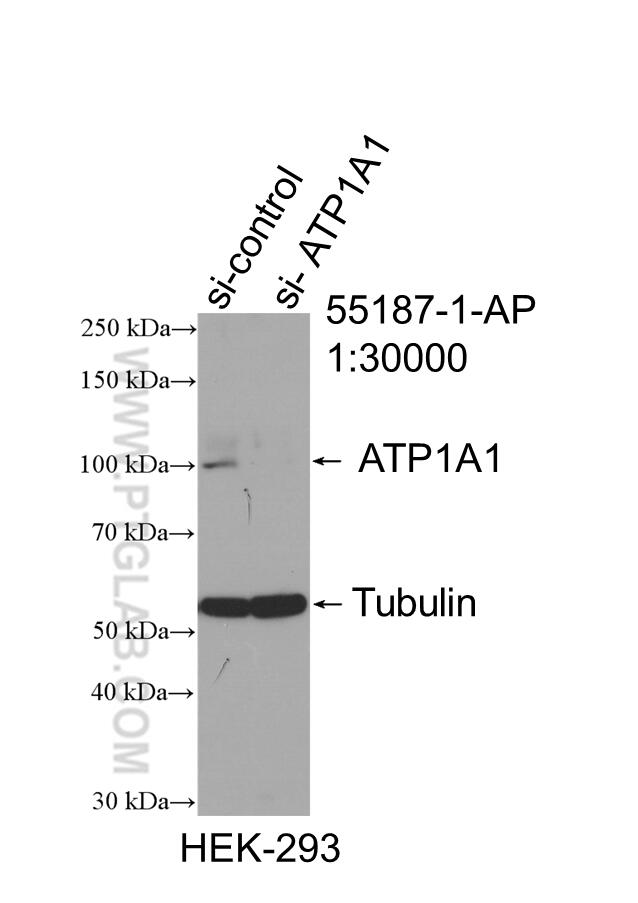 Western Blot (WB) analysis of HEK-293 cells using ATP1A1-Specific Polyclonal antibody (55187-1-AP)