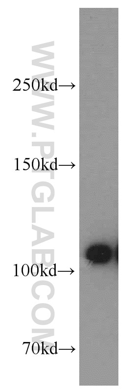 Western Blot (WB) analysis of MCF-7 cells using ATP1A1-Specific Polyclonal antibody (55187-1-AP)
