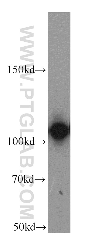 Western Blot (WB) analysis of HepG2 cells using ATP1A1-Specific Polyclonal antibody (55187-1-AP)