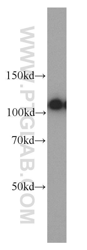 Western Blot (WB) analysis of HEK-293 cells using ATP1A1-Specific Polyclonal antibody (55187-1-AP)