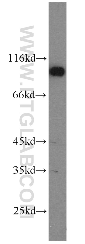 WB analysis of Neuro-2a using 55187-1-AP