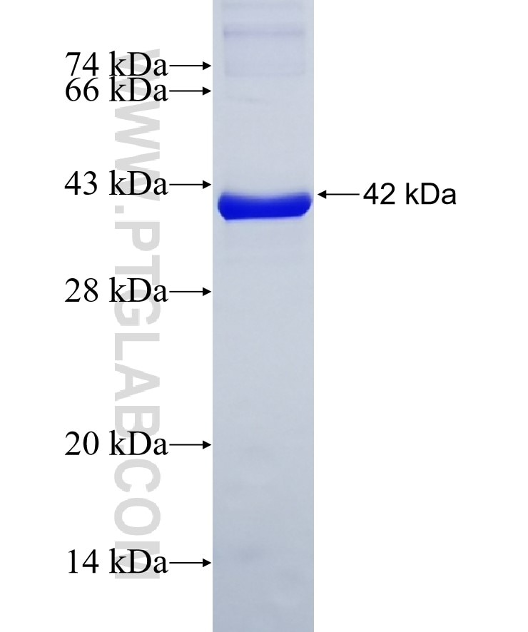 ATP1A1 fusion protein Ag5990 SDS-PAGE