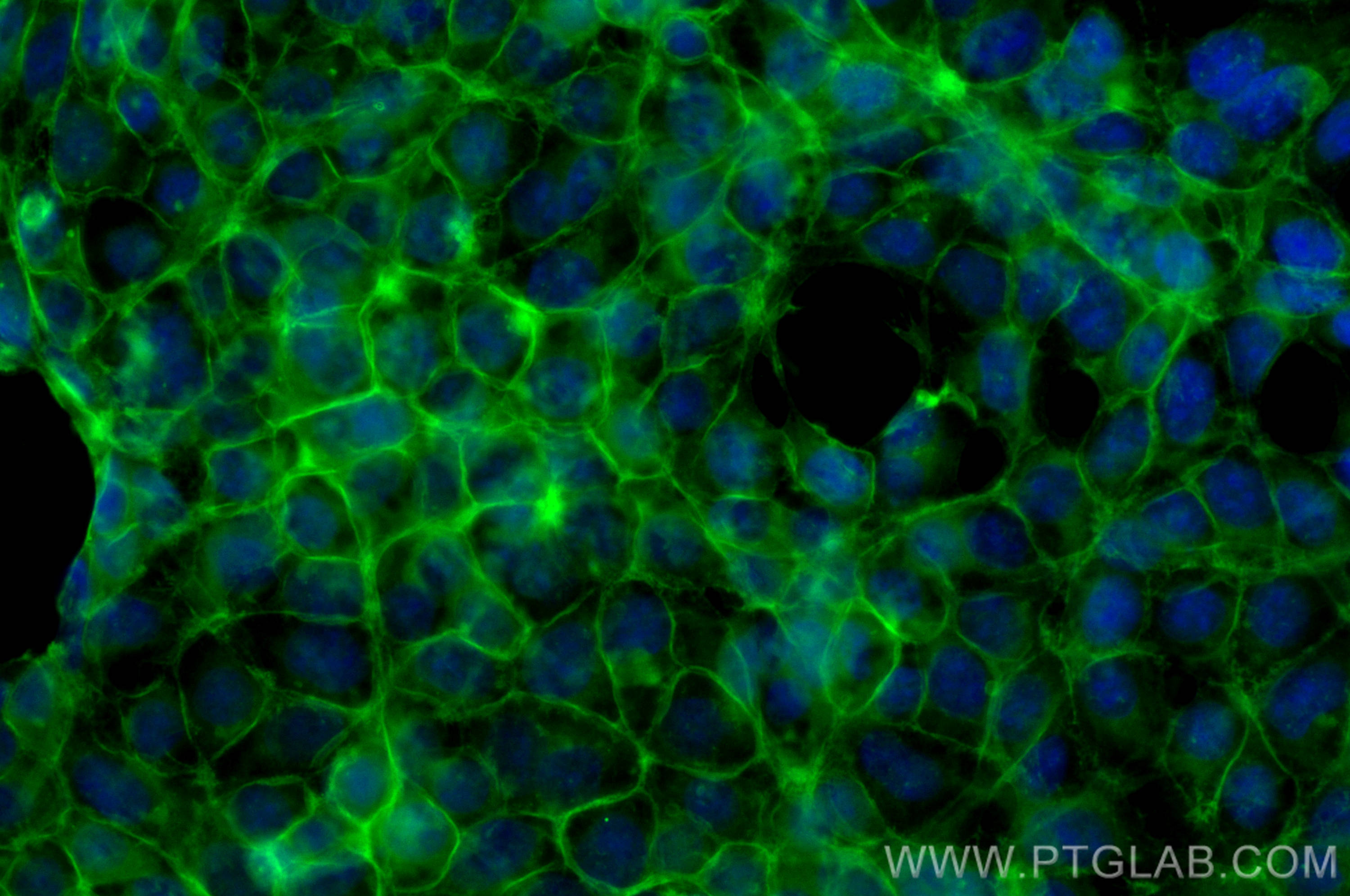 Immunofluorescence (IF) / fluorescent staining of HEK-293 cells using CoraLite® Plus 488-conjugated ATP1A1-Specific Poly (CL488-55187)