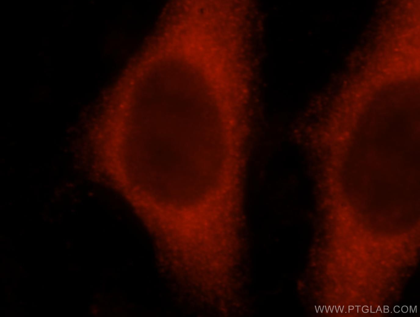 Immunofluorescence (IF) / fluorescent staining of HeLa cells using ATP1A2 Polyclonal antibody (16836-1-AP)