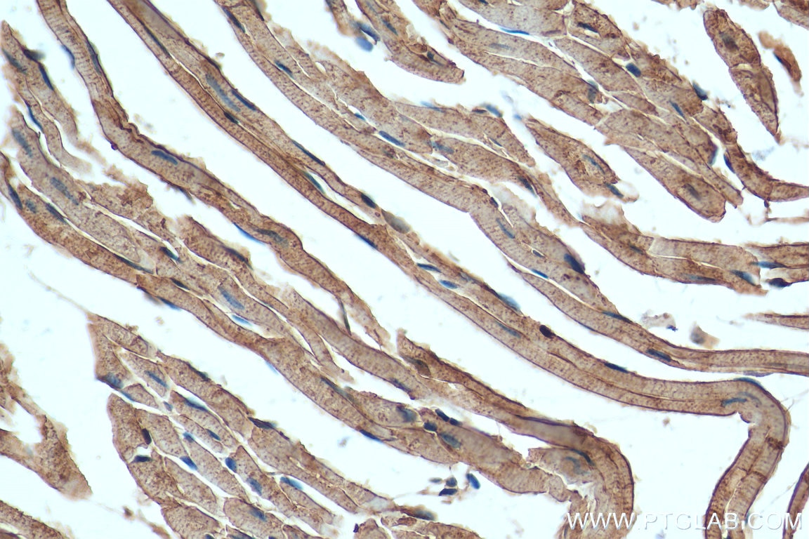Immunohistochemistry (IHC) staining of mouse heart tissue using ATP1A2 Polyclonal antibody (16836-1-AP)