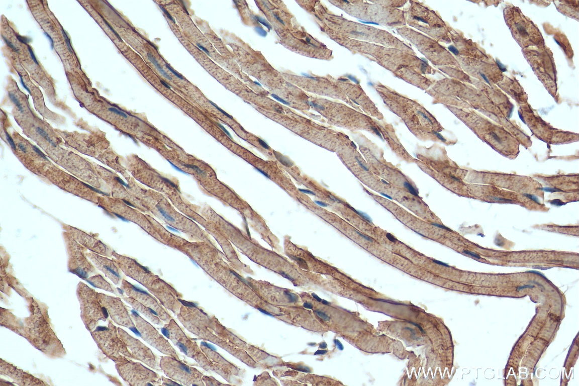 IHC staining of mouse heart using 16836-1-AP