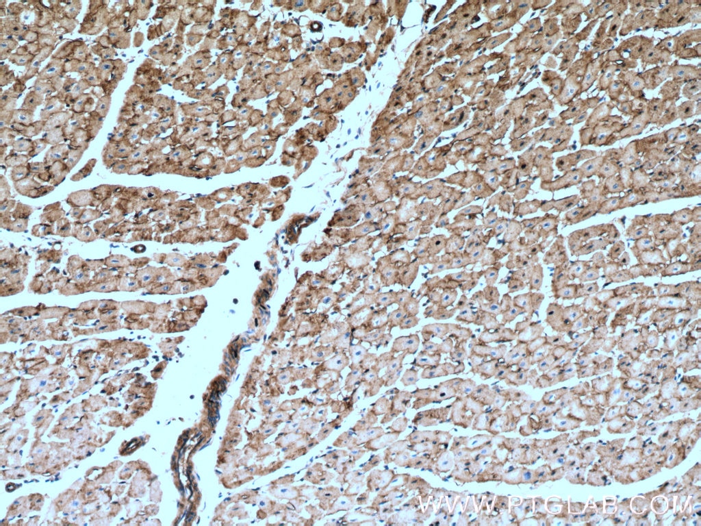 IHC staining of human heart using 16836-1-AP