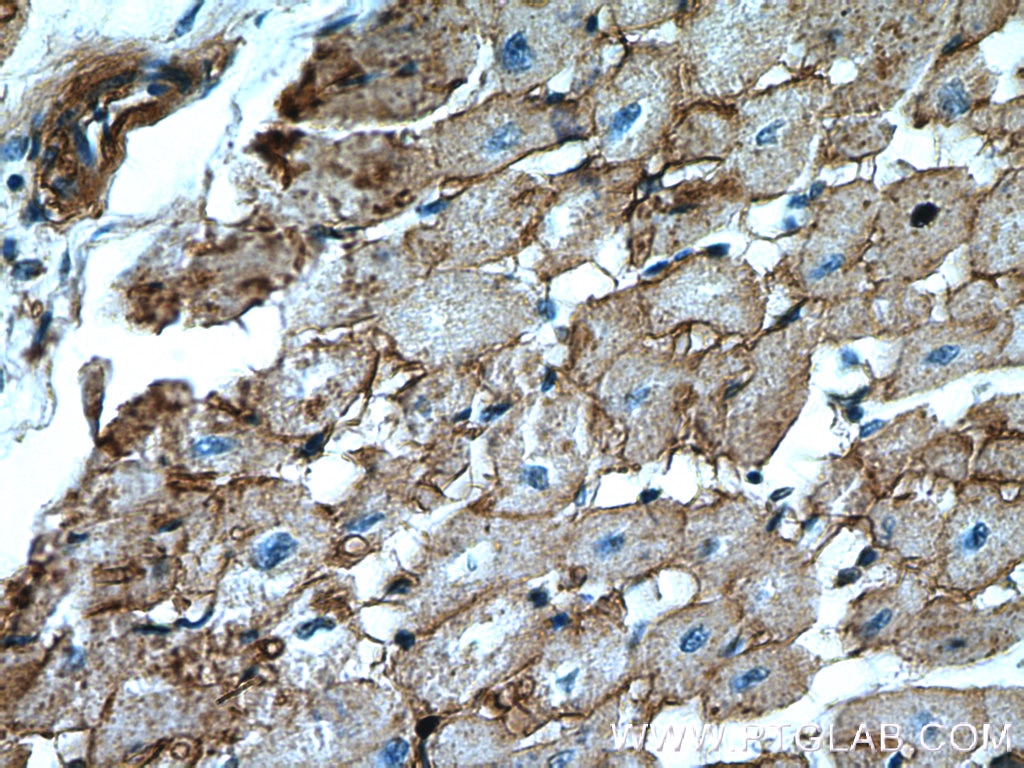 Immunohistochemistry (IHC) staining of human heart tissue using ATP1A2 Polyclonal antibody (16836-1-AP)