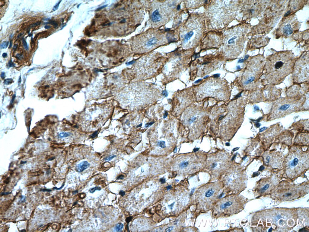 IHC staining of human heart using 16836-1-AP