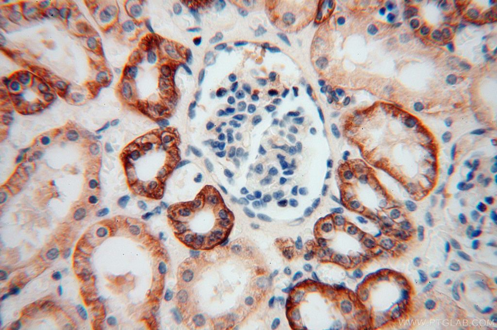 IHC staining of human kidney using 16836-1-AP