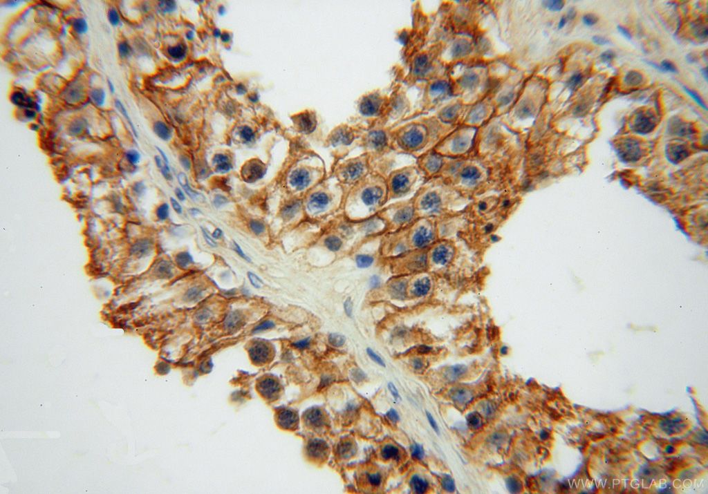Immunohistochemistry (IHC) staining of human testis tissue using ATP1A2 Polyclonal antibody (16836-1-AP)