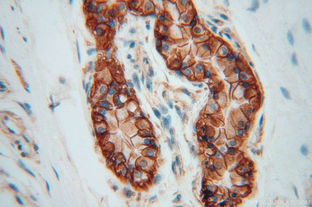 Immunohistochemistry (IHC) staining of human skin tissue using ATP1A2 Polyclonal antibody (16836-1-AP)