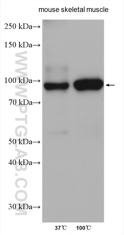 Western Blot (WB) analysis of various lysates using ATP1A2 Polyclonal antibody (16836-1-AP)