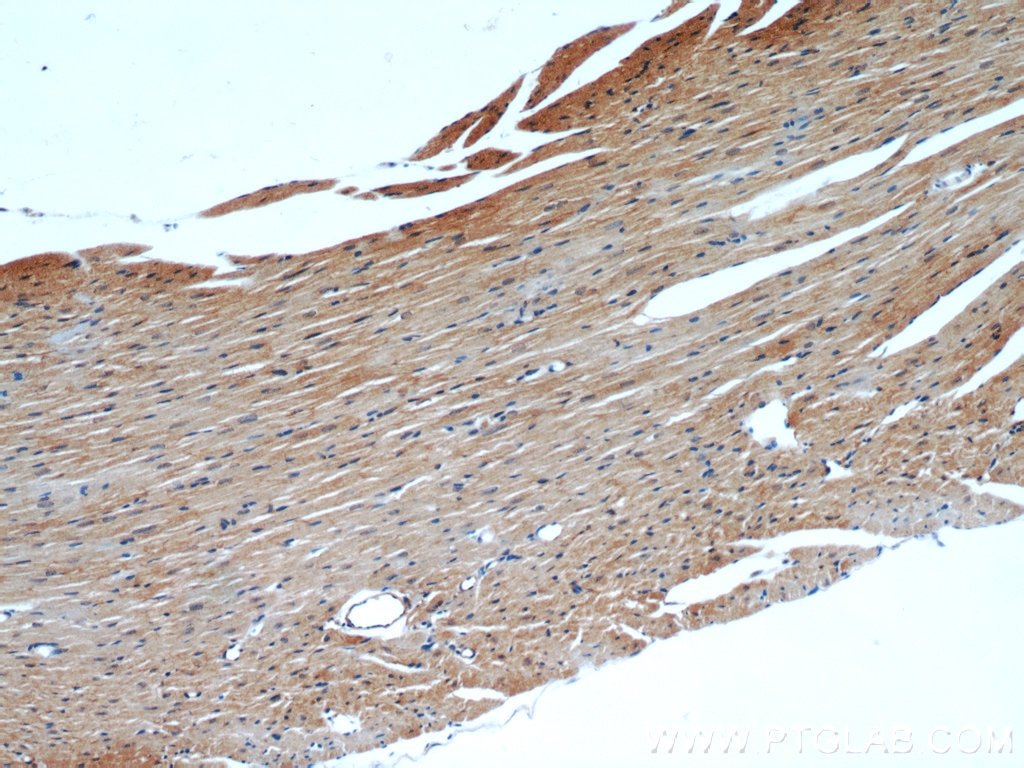 Immunohistochemistry (IHC) staining of mouse heart tissue using ATP1A2-Specific Polyclonal antibody (55179-1-AP)