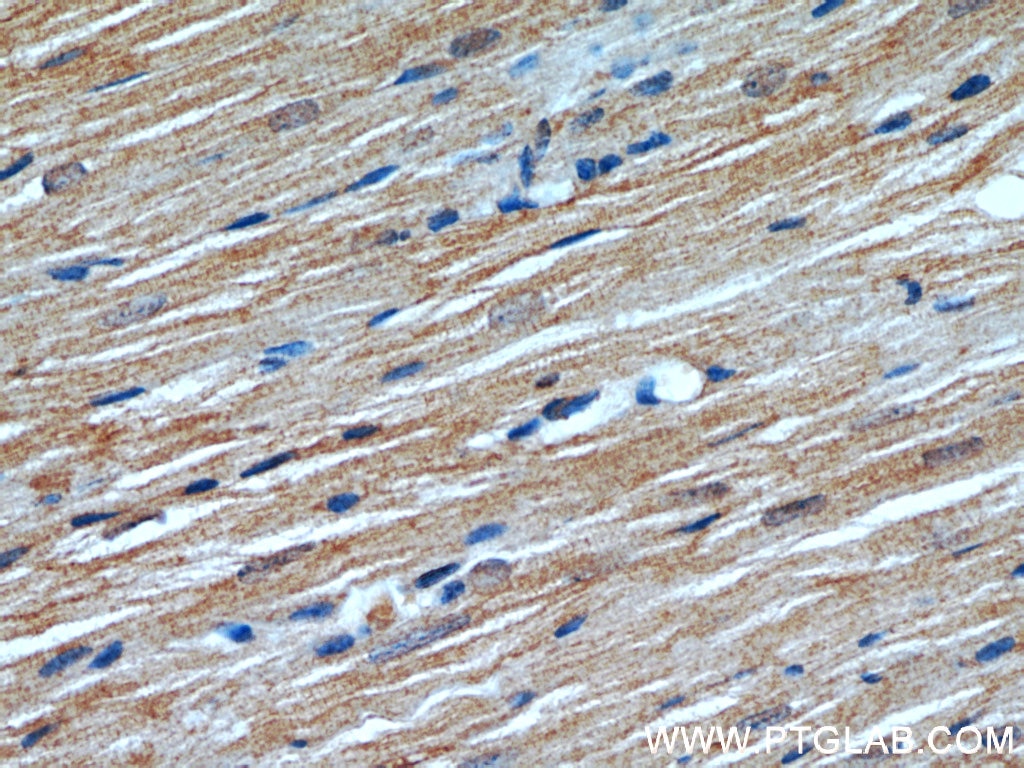 Immunohistochemistry (IHC) staining of mouse heart tissue using ATP1A2-Specific Polyclonal antibody (55179-1-AP)