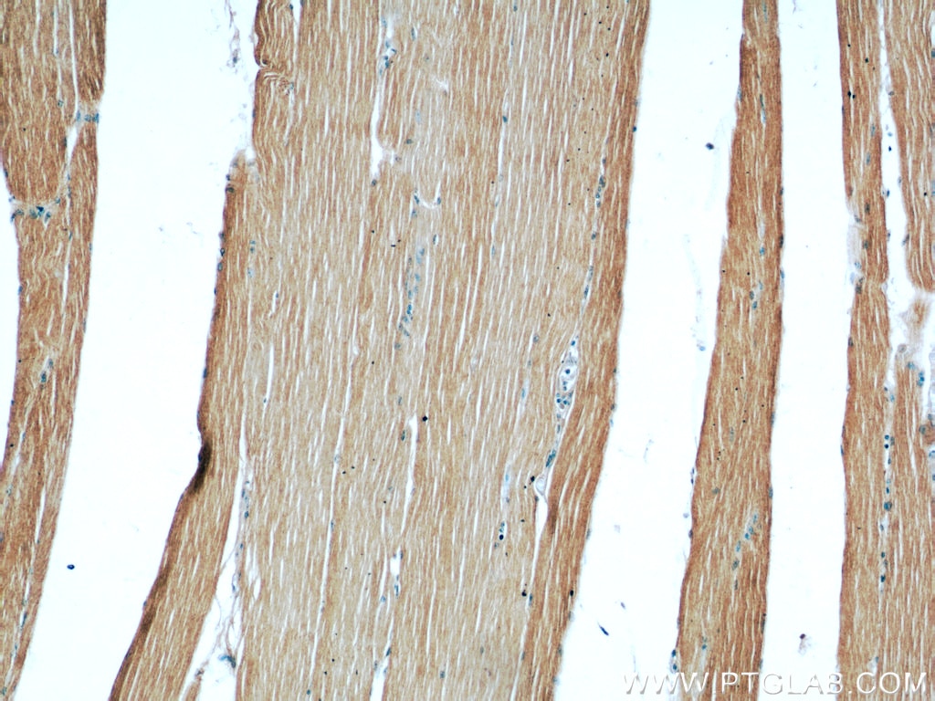 Immunohistochemistry (IHC) staining of human skeletal muscle tissue using ATP1A2-Specific Polyclonal antibody (55179-1-AP)