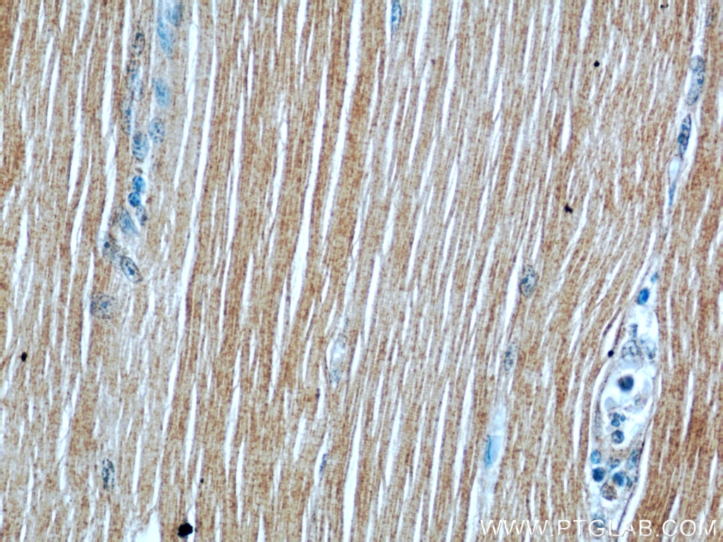 Immunohistochemistry (IHC) staining of human skeletal muscle tissue using ATP1A2-Specific Polyclonal antibody (55179-1-AP)