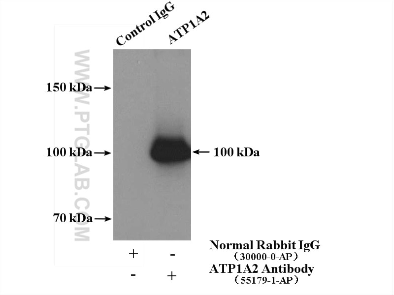 Immunoprecipitation (IP) experiment of mouse brain tissue using ATP1A2-Specific Polyclonal antibody (55179-1-AP)