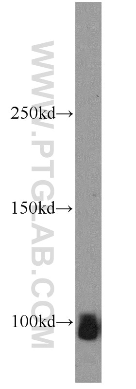 Western Blot (WB) analysis of mouse brain tissue using ATP1A2-Specific Polyclonal antibody (55179-1-AP)