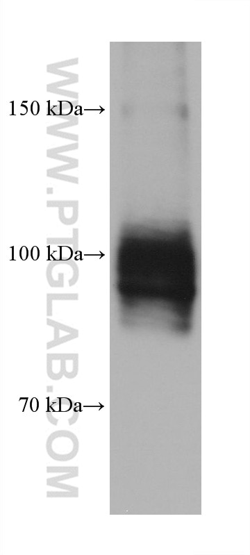 Western Blot (WB) analysis of SK-BR-3 cells using ATP1A1/2 Monoclonal antibody (68505-1-Ig)