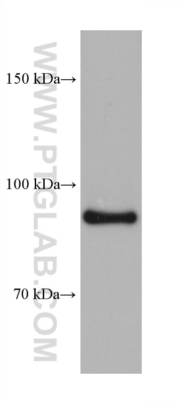 WB analysis of rat kidney using 68505-1-Ig